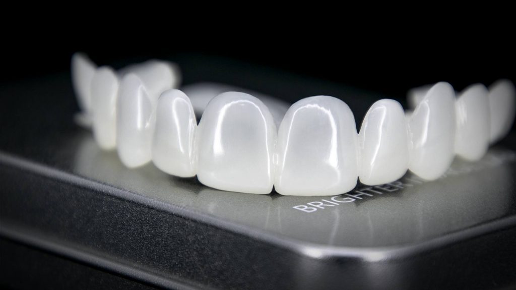 press on veneers amazon
