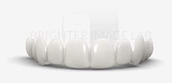Brighter Image Lab Dental Veneers