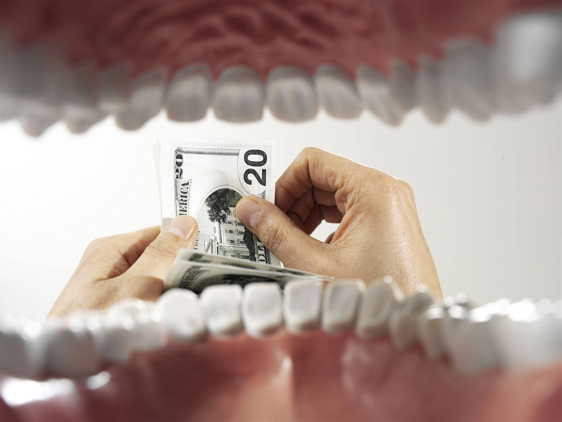 porcelain veneers porcelain veneers